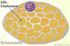 Schaumzelle mit eingeschlossenem Cholesterin