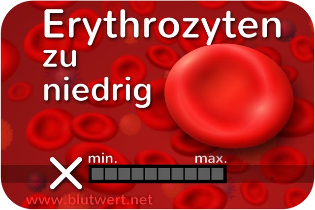 Zu wenig Erythrozyten: Blutwert Ery vermindert, zu niedrig