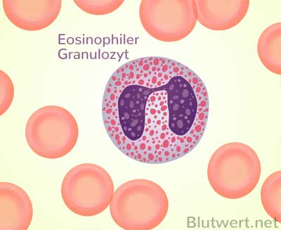 Eosinophiler Granulozyt