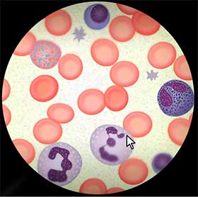 Blutbild: Untersuchung der Blutzellen