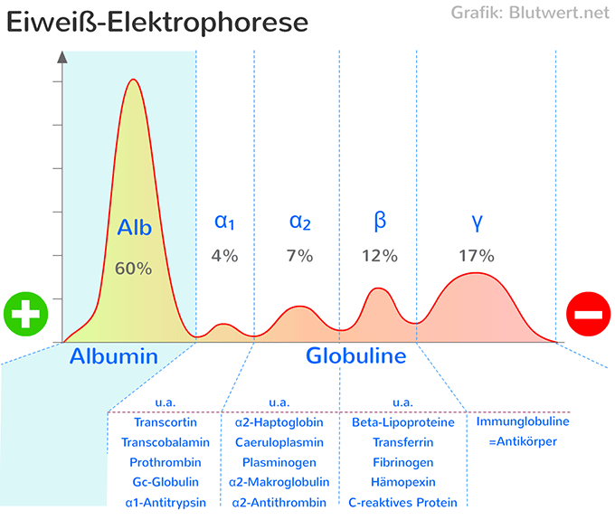 Elektrophorese (Kurve): Trennung verschiedener Proteine