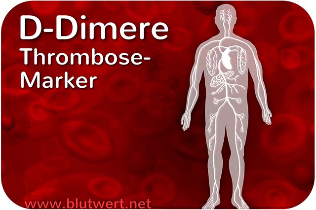 D-Dimere: Thrombose-Marker (Blutwert)